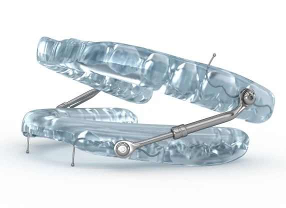 orthese avancee mandibulaire