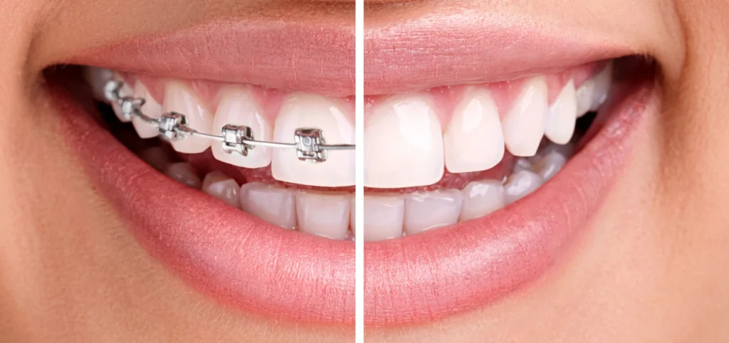 orthodontie docteur vincent robert