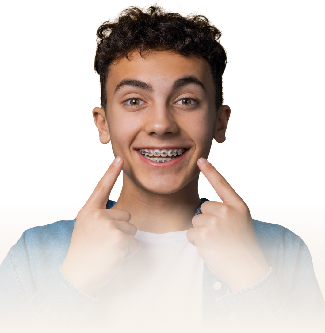 Système multi-attaches autoligaturant