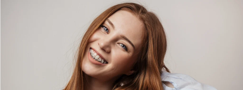 bagues adolescents molsheim bagues adolescents molsheim Orthodontiste près de Wasselonne : aligneurs transparents et appareil multi-attaches au cabinet du Dr Robert Dr Vincent Robert | Orthodontiste à Molsheim