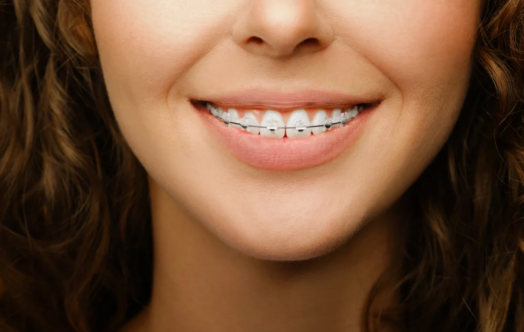 multi bagues adultes