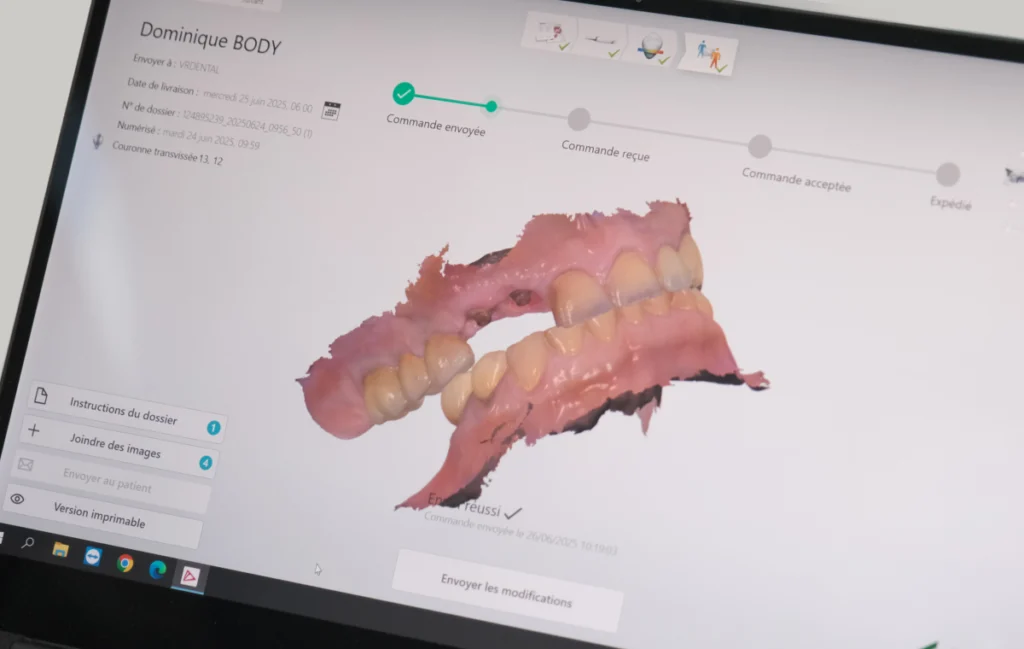 orthodontie molsheim empreinte numerique orthodontie molsheim empreinte numerique Orthodontiste près de Mutzig : aligneurs transparents et appareil multi-attaches avec le Dr Vincent Robert Dr Vincent Robert | Orthodontiste à Molsheim